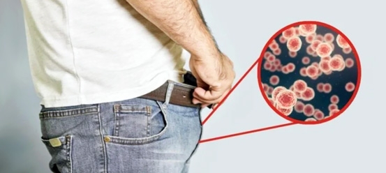 Erkeklerde Genital Siğil Tedavisi